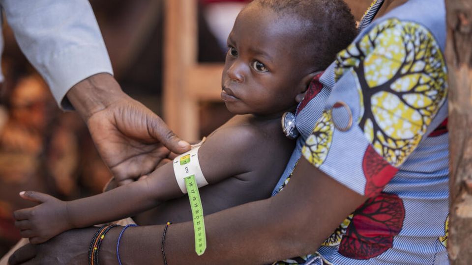 ZAMBIA FACED WITH TRIPLE BURDEN OF MALNUTRITION ACROSS ALL AGE GROUPS